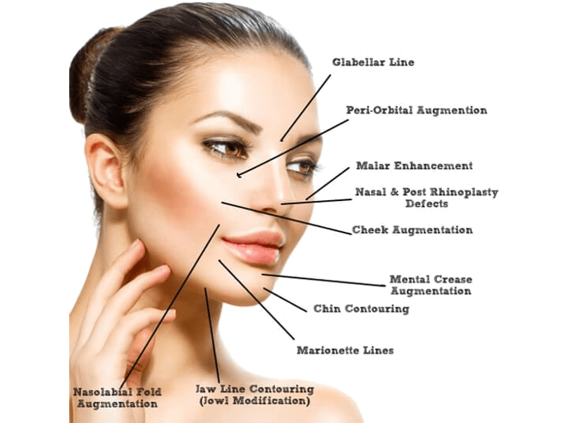 Dermal fillers can rejuvenate the face by replacing volume, plumping lips, and contouring cheeks and jaw line. 